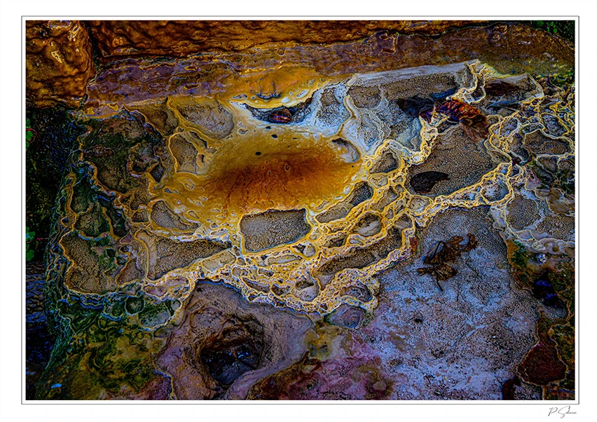 Concretion des tartre